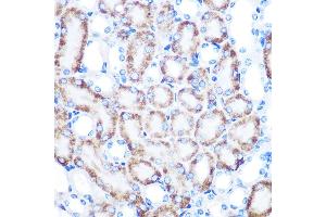 Immunohistochemistry of paraffin-embedded mouse kidney using [KO Validated] CD168/RHAMM Rabbit mAb  at dilution of 1:100 (40x lens). (HMMR antibody)