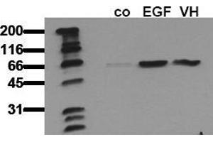 Western Blotting (WB) image for anti-V-Akt Murine Thymoma Viral Oncogene Homolog 1 (AKT1) (pSer473) antibody (ABIN126853) (AKT1 antibody  (pSer473))