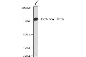 Western blot analysis of extracts of  cells, using Cytokeratin 1 (KRT1) (KRT1) Rabbit mAb (ABIN7268085) at 1:1000 dilution.