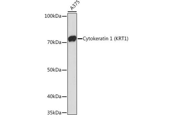 Cytokeratin 1 anticorps