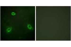 Immunofluorescence analysis of HepG2 cells, using TM16G Antibody. (Anoctamin 7 antibody  (AA 881-930))