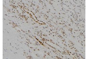 ABIN6256832 and ABIN6273678 at 1/100 staining Human kidney tissue by IHC-P.