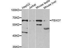 Western blot analysis of extracts of various cell lines, using FBXO7 antibody. (FBXO7 antibody)