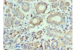 Immunohistochemistry of paraffin-embedded human salivary gland tissue using ABIN7145996 at dilution of 1:100 (CCL28 antibody  (AA 20-127))