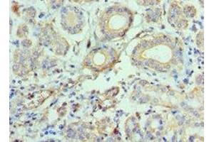 Immunohistochemistry of paraffin-embedded human salivary gland tissue using ABIN7145996 at dilution of 1:100