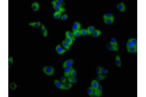 Immunofluorescence staining of HepG2 cells with ABIN7161093 at 1:100, counter-stained with DAPI. (SLC11A2 antibody  (AA 1-69))