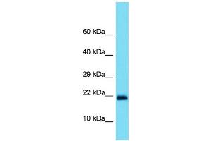 Host: Rabbit Target Name: SOD1 Sample Type: Placenta lysates Antibody Dilution: 1.