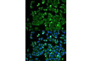 Immunofluorescence analysis of HeLa cells using NF2 antibody. (Merlin antibody  (AA 19-595))