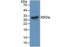 Detection of Recombinant CHGB, Human using Polyclonal Antibody to Chromogranin B (CHGB) (CHGB antibody  (AA 496-669))