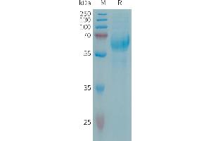CSPG5 Protein (AA 31-420) (His tag)
