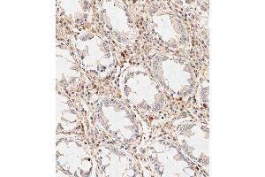 Immunohistochemical analysis of paraffin-embedded human colon tissue using (ABIN389185 and ABIN2839348) performed on the Leica® BOND RXm. (WIF1 antibody  (C-Term))