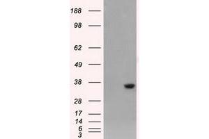 HEK293T cells were transfected with the pCMV6-ENTRY control (Left lane) or pCMV6-ENTRY AKR1A1 (Right lane) cDNA for 48 hrs and lysed. (AKR1A1 antibody)