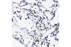 Immunohistochemistry of paraffin-embedded rat lung using Phospho-c-Jun-T91 Rabbit pAb (ABIN7268058) at dilution of 1:50 (40x lens). (C-JUN antibody  (pThr91))
