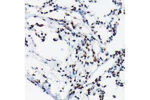 Immunohistochemistry of paraffin-embedded rat lung using Phospho-c-Jun-T91 Rabbit pAb (ABIN7268058) at dilution of 1:50 (40x lens).