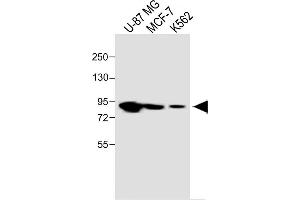 All lanes :PLOD1 Antibody (N-term) at 1:1000 dilution Lane 1: U-87 MG whole cell lysate Lane 2: MCF-7 whole cell lysate Lane 3: K562 whole cell lysate Lysates/proteins at 20 μg per lane.