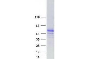 Estrogen-Related Receptor beta (ESRRB) protein (Myc-DYKDDDDK Tag)