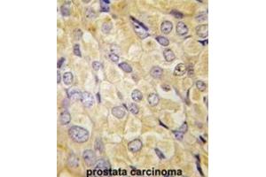 Immunohistochemistry (IHC) image for anti-Frizzled Family Receptor 1 (Fzd1) antibody (ABIN3001613) (FZD1 antibody)