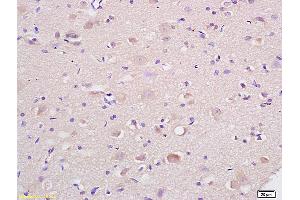 Formalin-fixed and paraffin embedded rat brain labeled with Anti-HSP75/TRAP1 Polyclonal Antibody, Unconjugated (ABIN686647) at 1:200 followed by conjugation to the secondary antibody and DAB staining. (TRAP1 antibody  (AA 501-650))