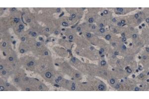 Detection of PCT in Human Liver Tissue using Monoclonal Antibody to Procalcitonin (PCT) (Procalcitonin antibody  (AA 26-141))