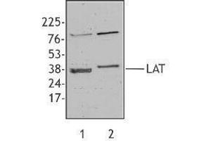 Western Blotting (WB) image for anti-Linker For Activation of T Cells (LAT) antibody (ABIN2666055) (LAT antibody)