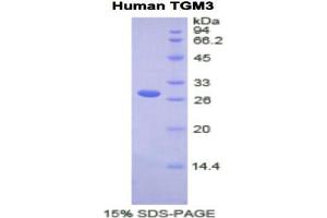 SDS-PAGE analysis of Human TGM3 Protein. (TGM3 Protein)