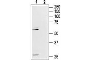 Western blot analysis of rat hippocampus lysate: - 1. (Mu Opioid Receptor 1 antibody  (Extracellular, N-Term))