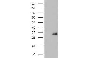 Western Blotting (WB) image for anti-Proteasome (Prosome, Macropain) Subunit, beta Type, 4 (PSMB4) antibody (ABIN1500474) (PSMB4 antibody)