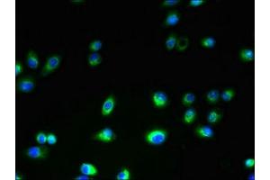 Immunofluorescent analysis of A2780 cells using ABIN7173023 at dilution of 1:100 and Alexa Fluor 488-congugated AffiniPure Goat Anti-Rabbit IgG(H+L) (ANO1 antibody  (AA 1-94))