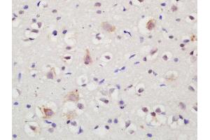 Formalin-fixed and paraffin embedded rat brain labeled with Rabbit Anti-NTR3 Polyclonal Antibody, Unconjugated (ABIN872315) at 1:200 followed by conjugation to the secondary antibody and DAB staining (Sortilin 1 antibody  (AA 731-831))
