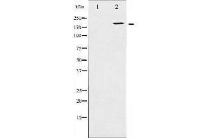 Western blot analysis of HER2 phosphorylation expression in EGF treated SK-OV3 whole cell lysates,The lane on the left is treated with the antigen-specific peptide. (ErbB2/Her2 antibody  (pTyr1248))