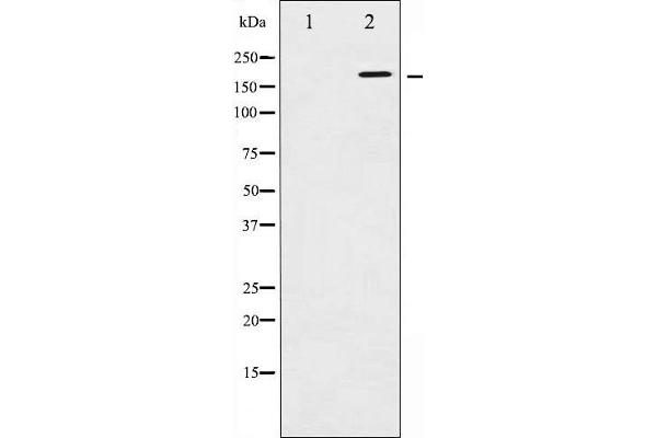 ErbB2/Her2 antibody  (pTyr1248)