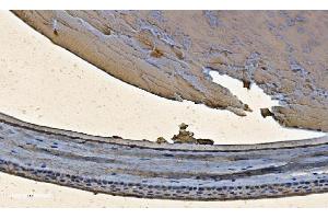 IHC analysis of Alpha B Crystallin/CRYAB using anti-Alpha B Crystallin/CRYAB antibody (ABIN7601209). (CRYAB antibody  (AA 30-151))