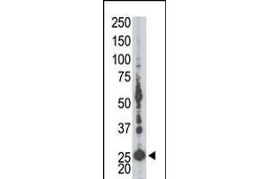 Antibody is used in Western blot to detect AK5 in mouse liver tissue lysate. (Adenylate Kinase 5 antibody  (N-Term))