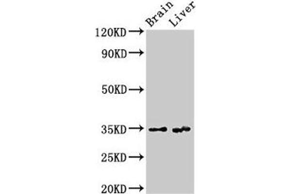 Ribokinase antibody  (AA 2-322)