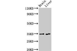 Western Blot Positive WB detected in: Rat brain tissue, Rat liver tissue All lanes: RBKS antibody at 3.