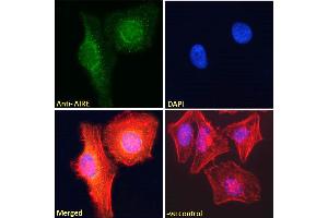 Immunofluorescence (IF) image for anti-Autoimmune Regulator (AIRE) (C-Term) antibody (ABIN184780)