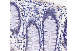 Immunohistochemistry analysis of paraffin-embedded human stomach using,PARN (ABIN7075117) at dilution of 1: 1800 (PARN antibody)