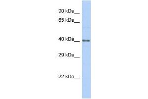 Host:  Rabbit  Target Name:  HKR1  Sample Type:  Hela Whole Cell lysates  Antibody Dilution:  1. (HKR1 antibody  (C-Term))