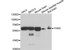 Western blot analysis of extracts of various cell lines, using YARS antibody (ABIN5974115) at 1/1000 dilution. (YARS antibody)