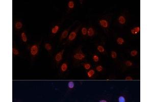Immunofluorescence analysis of C6 cells using HNRNPU Polyclonal Antibody at dilution of 1:100. (HNRNPU antibody)