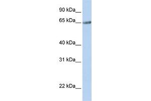 WB Suggested Anti-TM9SF1 Antibody Titration:  0. (TM9SF1 antibody  (N-Term))