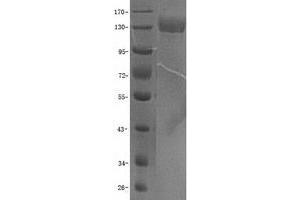 Validation with Western Blot (ITGA5 Protein (GST tag))