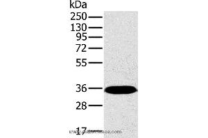 Western blot analysis of Mouse brain tissue, using PPP2CA Polyclonal Antibody at dilution of 1:450 (PPP2CA antibody)
