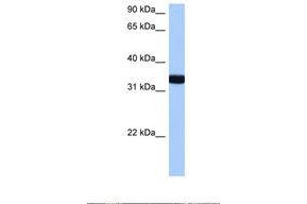GTPase, IMAP Family Member 1 (GIMAP1) (N-Term) antibody
