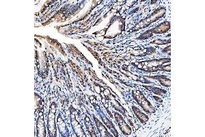 IHC analysis of SNRNP200 using anti-SNRNP200 antibody (ABIN7602032). (SNRNP200 antibody  (AA 557-2129))
