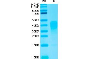 Biotinylated IL-13 on Tris-Bis PAGE under reduced conditions. (IL-13 Protein (AA 21-132) (His-Avi Tag,Biotin))
