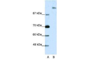 WB Suggested Anti-SUPT6H  Antibody Titration: 2. (Spt6 antibody  (N-Term))
