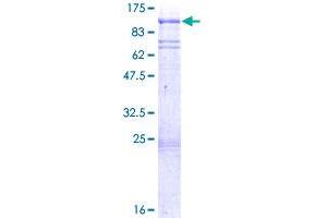PLK2 Protein (AA 1-685) (GST tag)