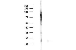 Western blot analysis of lysates from MDA-MB-231 cells(heat-shock,45 min treatment), using PR3 Antibody at 1/1000 dilution.