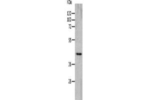 Western Blotting (WB) image for anti-Cholinergic Receptor, Nicotinic, alpha 7 (Neuronal) (CHRNA7) antibody (ABIN2426248) (CHRNA7 antibody)